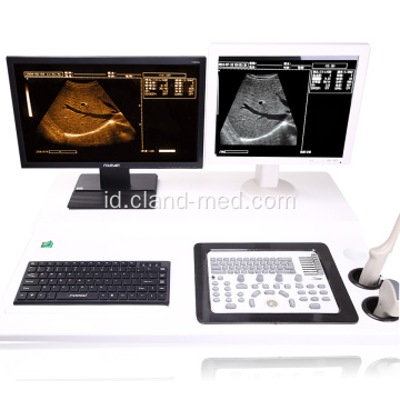 Mesin Ultrasound Trolley Digital Rumah Sakit dengan Workstation